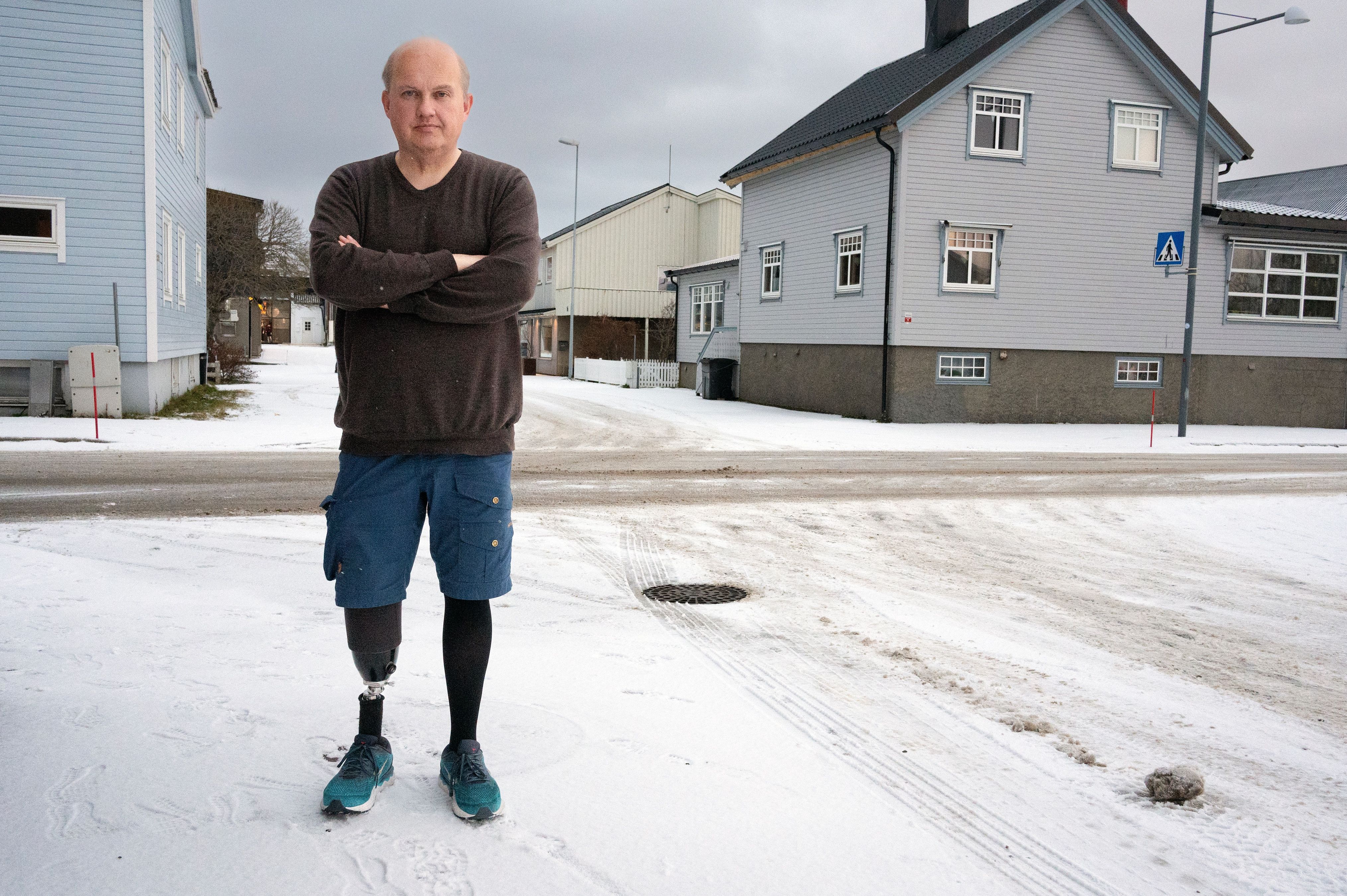 Blir du amputert – flytt sørover - vol.no