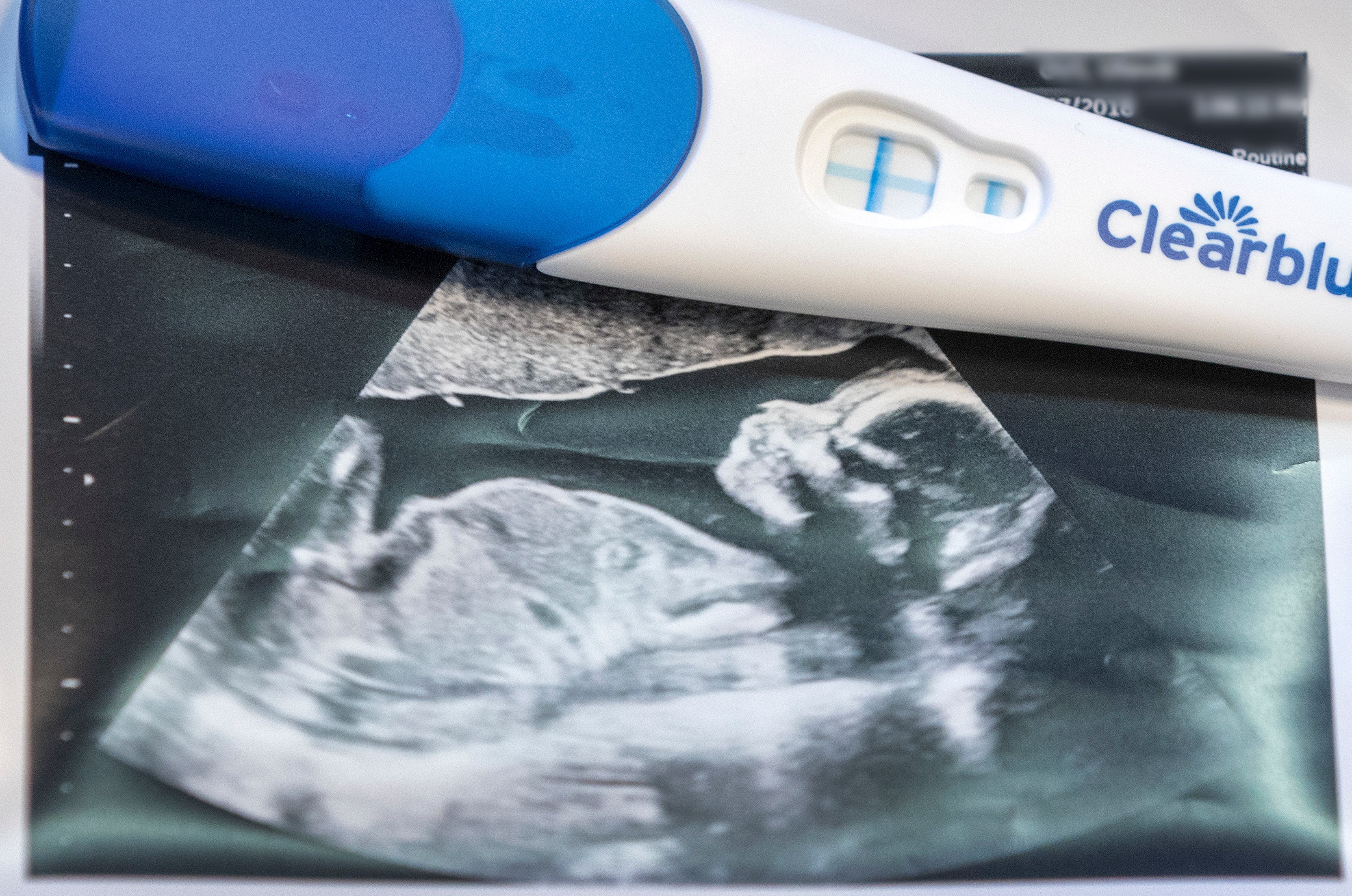 «Det å være et lite foster i Norge i dag er livsfarlig, og enda farli­gere ser det ut til å bli»