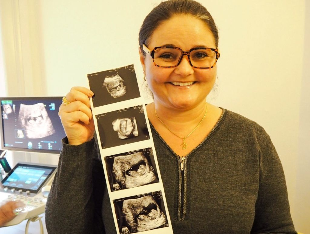 Kvinner Reiser Utenlands For Oppfylle Babydr mmen Med Andres Egg 