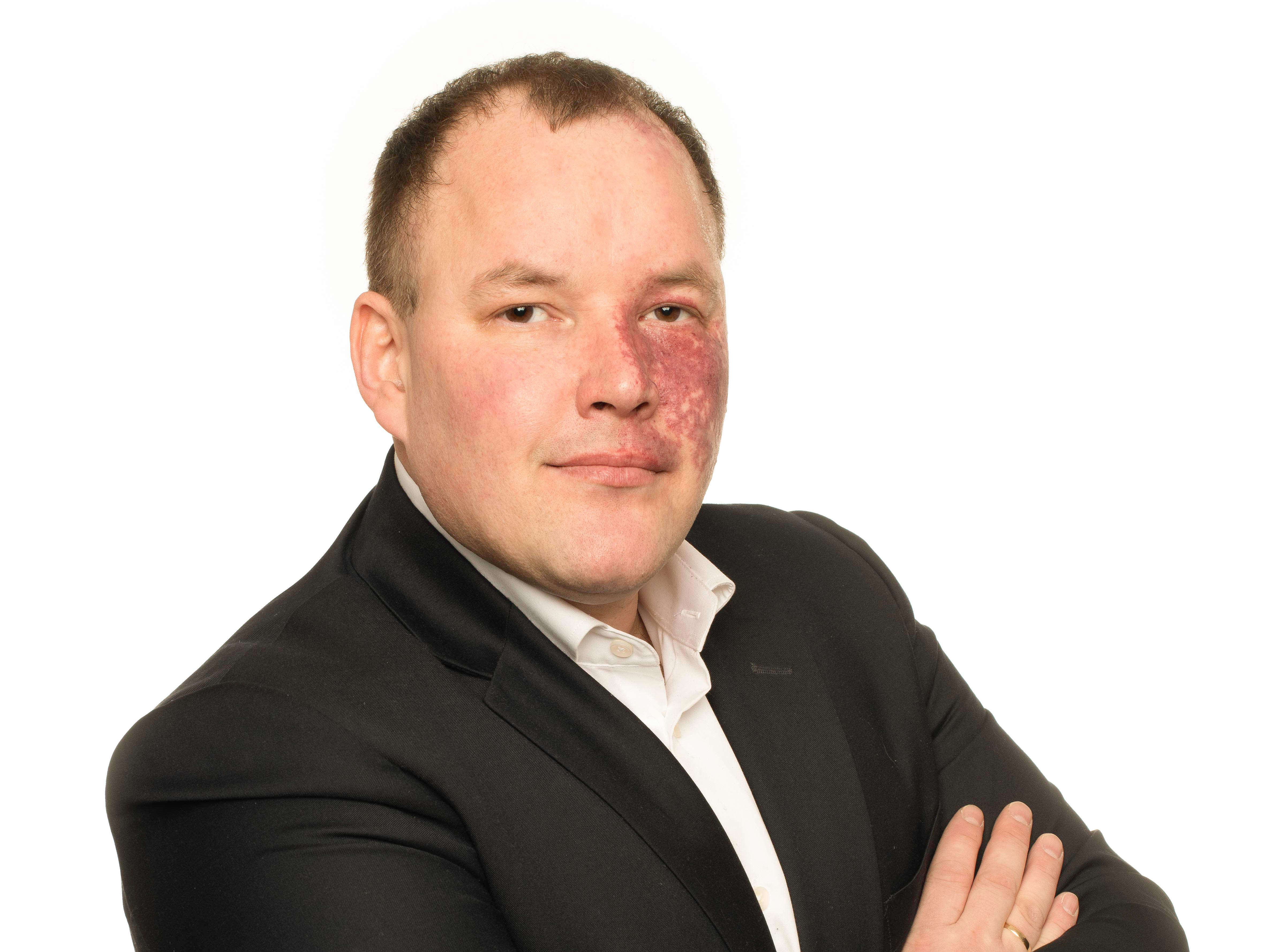 «To urede­ligheter blir ikke én sannhet»