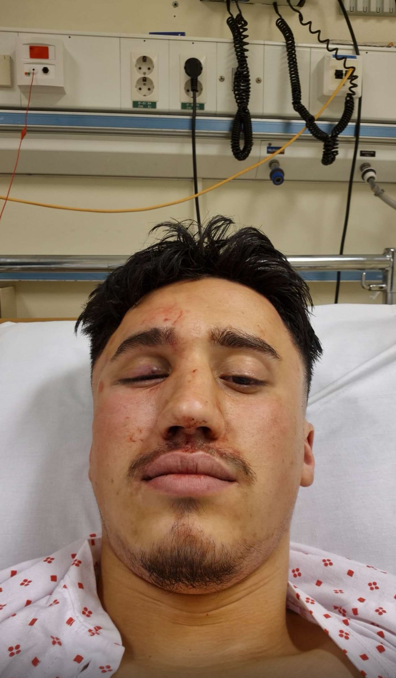 Utsatt for grov vold på åpen gate: – Trodde det var over for meg